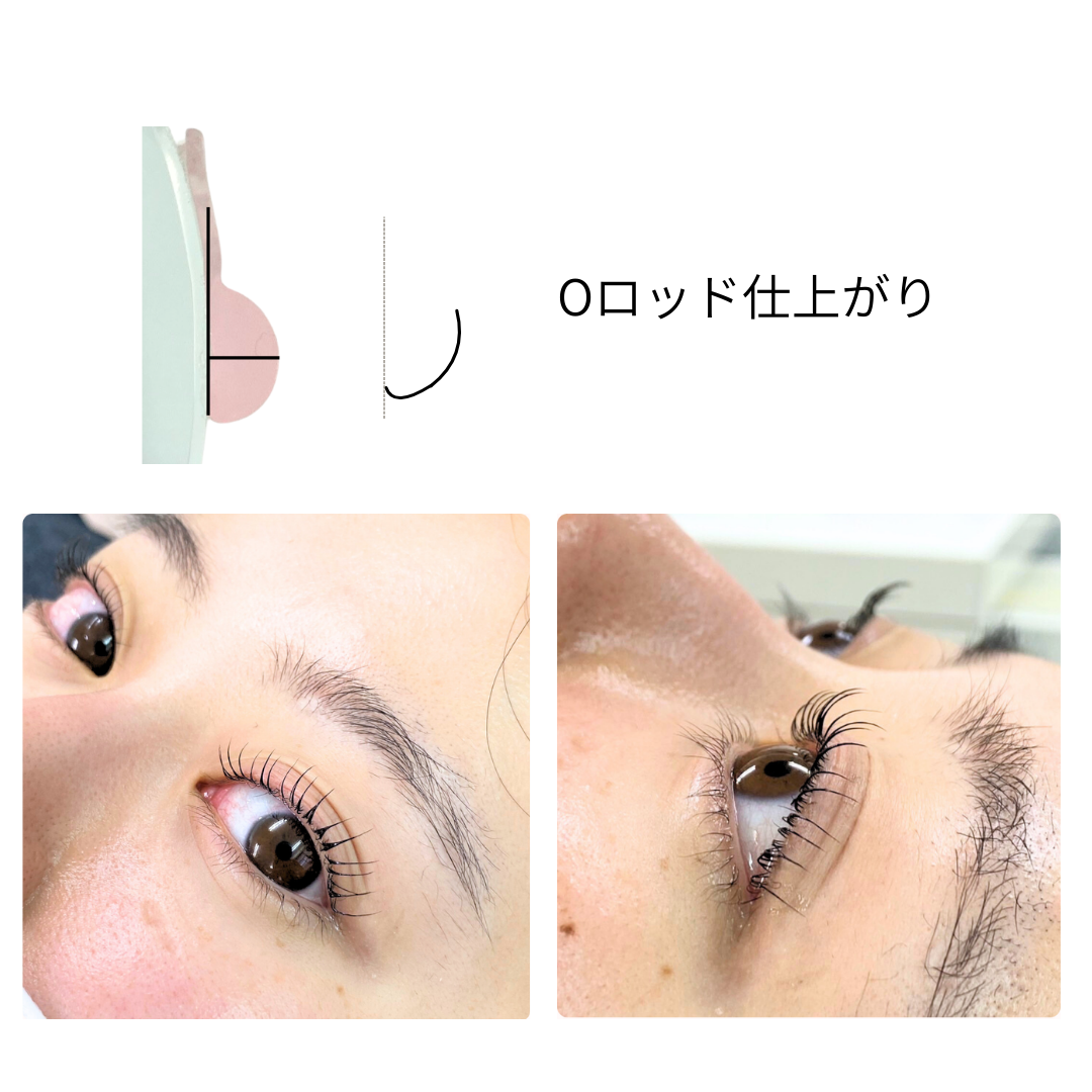 O 型杆（蓝色）
